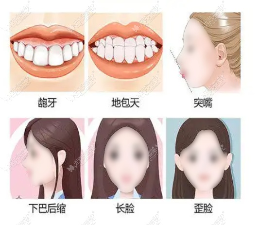 广州正颌手术医院排名榜