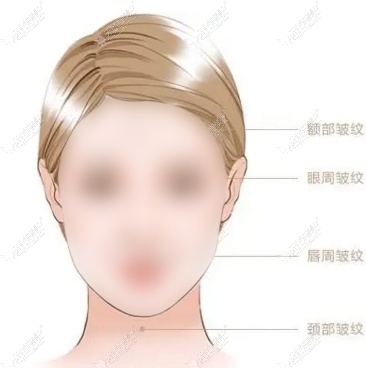 贵阳面部拉皮哪里做的好?做小拉皮好价格低是贵阳丽都,美莱