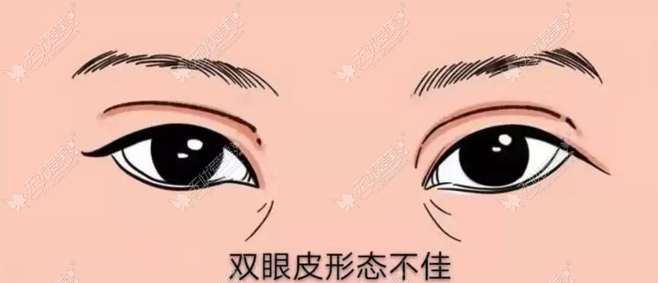 哈尔滨做眼修复好的前10名医生,吴谦|滕双艳做双眼皮修复实力强