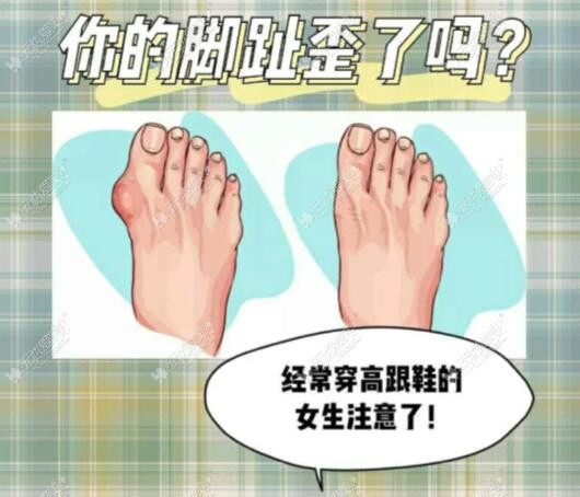 国内大脚骨正规医院名单无忧爱美网分享
