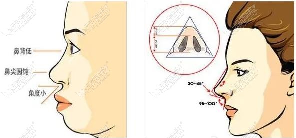 贵阳隆鼻哪个医生好51aimei.com 贵阳隆鼻哪个医生好51aimei.com