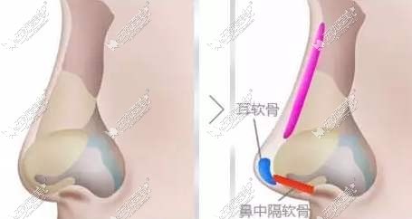 昆明隆鼻修复厉害的医生排名 昆明隆鼻修复厉害的医生排名