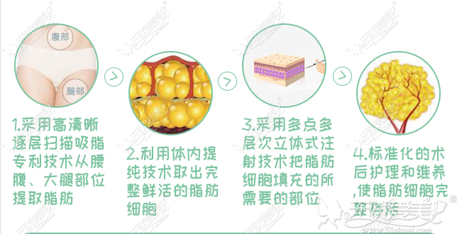 北京做脂肪修复的大佬 北京做脂肪修复的大佬