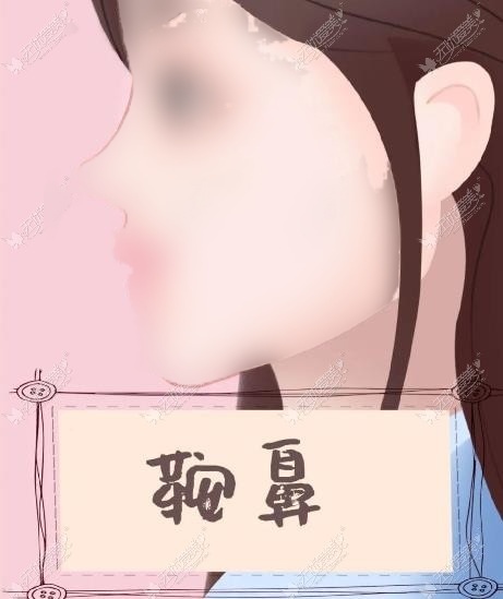 合肥隆鼻医生推荐名单 合肥隆鼻医生推荐名单