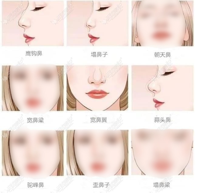 合肥做鼻子有名的医生 合肥做鼻子有名的医生