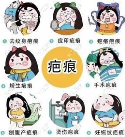 昆明昆大疤痕医院是昆明专做修复疤痕的医院 昆明昆大疤痕医院是昆明专做修复疤痕的医院