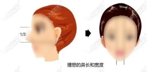 厦门海峡张宏做鼻综合如何