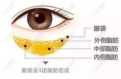 青岛去眼袋手术做得好的医生