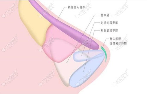 衡阳做鼻子好的口碑医生