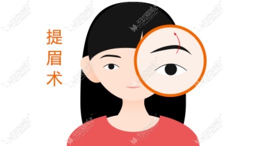 兰州提眉手术哪里做的好