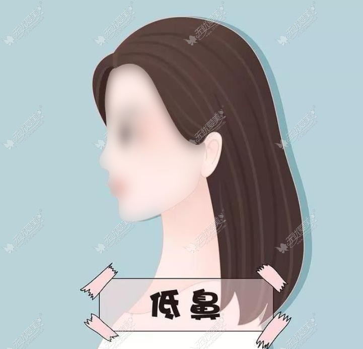 恩施隆鼻哪个医生好 恩施隆鼻哪个医生好
