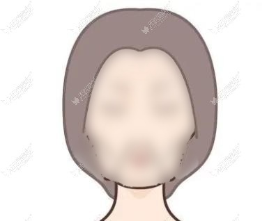 乌鲁木齐拉皮手术哪个医生做得好