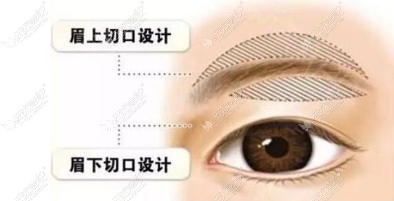 北京提眉术做得好的医生推荐名单:魏志香|田秋梅做切眉比较有名必推