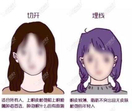 泉州双眼皮医生排名榜 泉州双眼皮医生排名榜