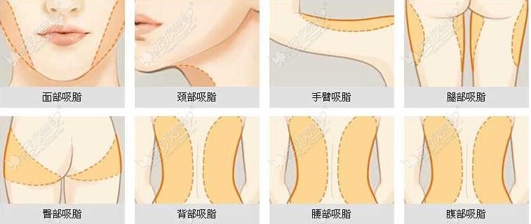 兰州谁做吸脂手术好51aimei.com