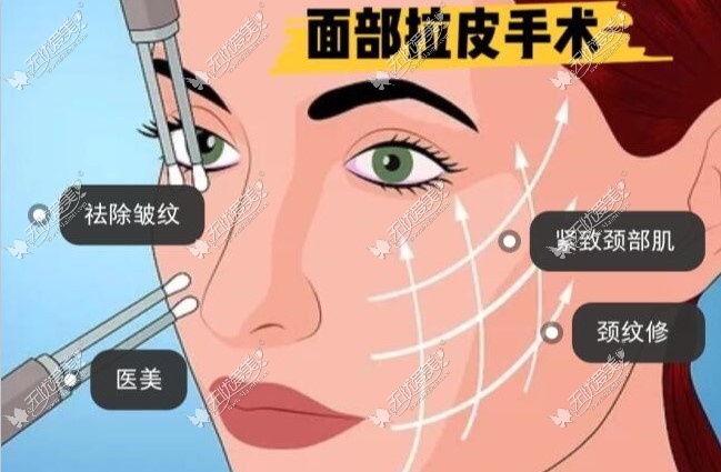 青岛做面部提升哪个医生好（青岛做埋线/大拉皮提升好的医生分享）