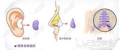 长沙星雅整形罗盛军