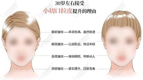沈阳小拉皮手术好的医生排名