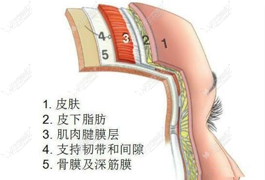 小切口拉皮手术技术图