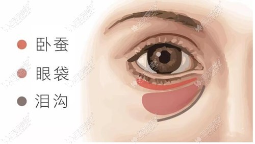 厦门割眼袋手术好的医生 厦门割眼袋手术好的医生