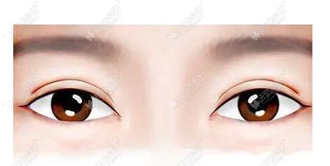 宁波双眼皮修复好的医生有哪些？
