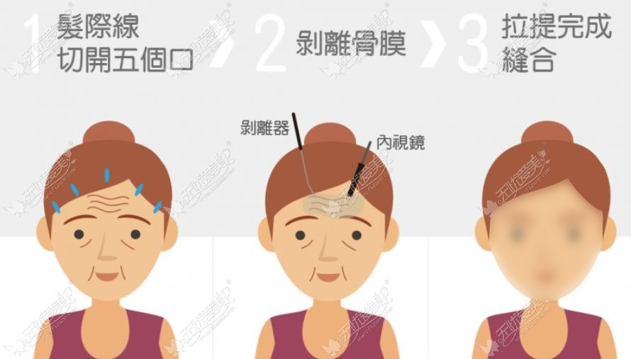武汉拉皮手术医院排名前十