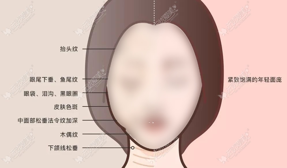 长春做拉皮手术好的医院排名公布 长春做拉皮手术好的医院排名公布