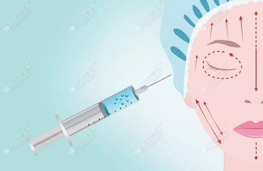 杭州打玻尿酸医院哪家好 杭州打玻尿酸医院哪家好