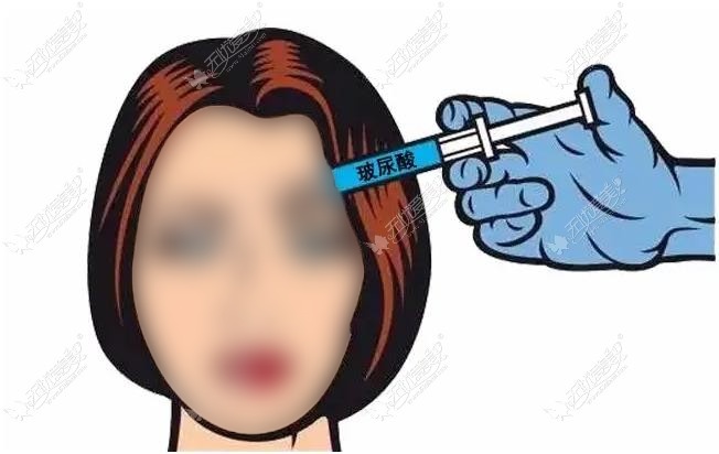 杭州打玻尿酸好的医院无忧爱美 杭州打玻尿酸好的医院无忧爱美