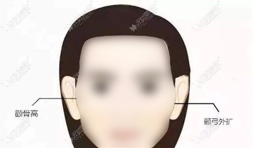 北京哪个医院颧骨整形好?排名榜名单参考 北京哪个医院颧骨整形好?排名榜名单参考