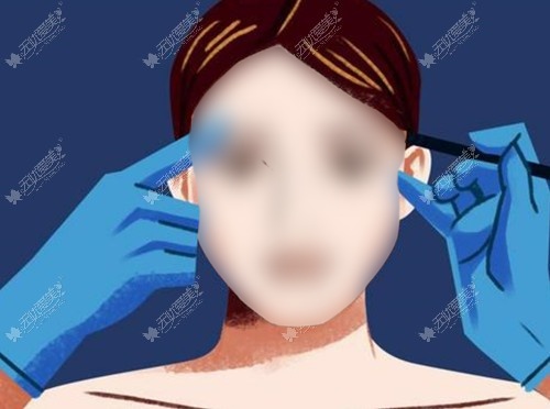 淄博做双眼皮好的整形医院排名:排名前五割双眼皮好价格也不贵