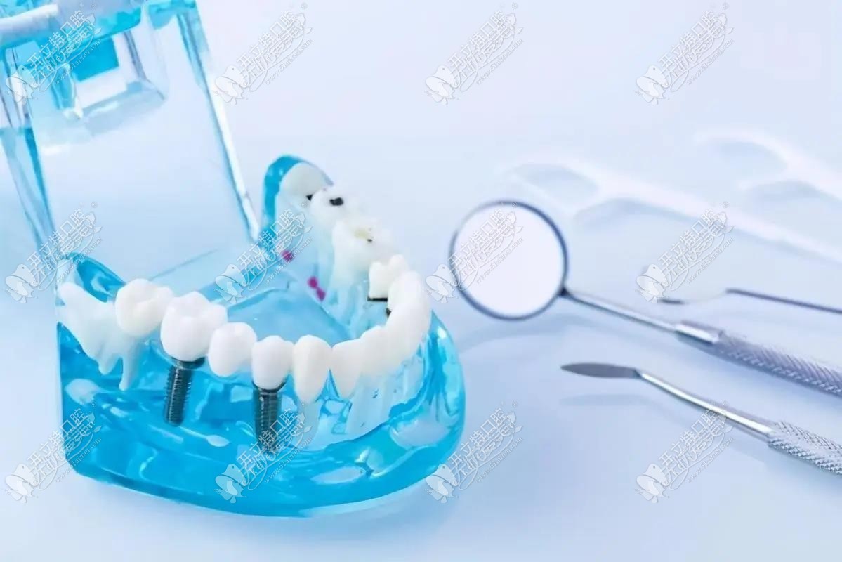 惠州惠城优芽口腔诊所 惠州惠城优芽口腔诊所