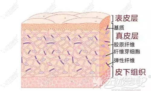 线雕原理