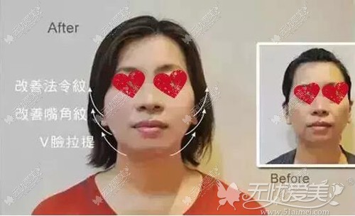 6d分层线雕案例
