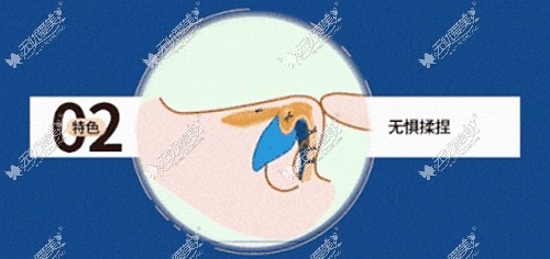 汪福强隆鼻怎么样
