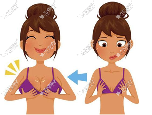 乳房再造术前后对比图