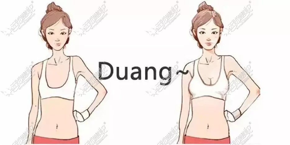 瘦人假体隆胸前后对比图片