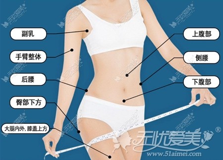 韩国JELIM脂减注射适合部位