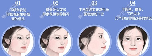 面部轮廓