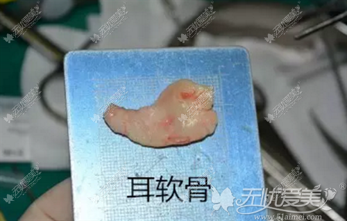 取下来的耳软骨样子