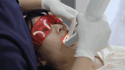 南京美莱口腔矫正前口扫取模 南京美莱口腔矫正前口扫取模