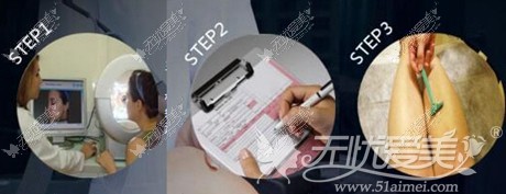 商丘欧兰整形冰点脱毛流程 商丘欧兰整形冰点脱毛流程
