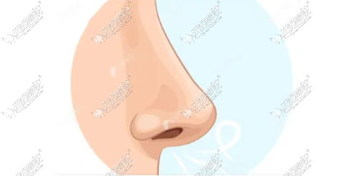李光琴做鼻子怎么样