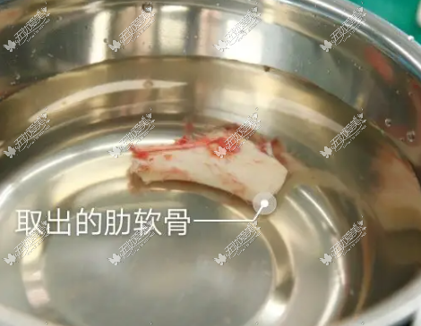m.51aimei.com广州做鼻子厉害的医生