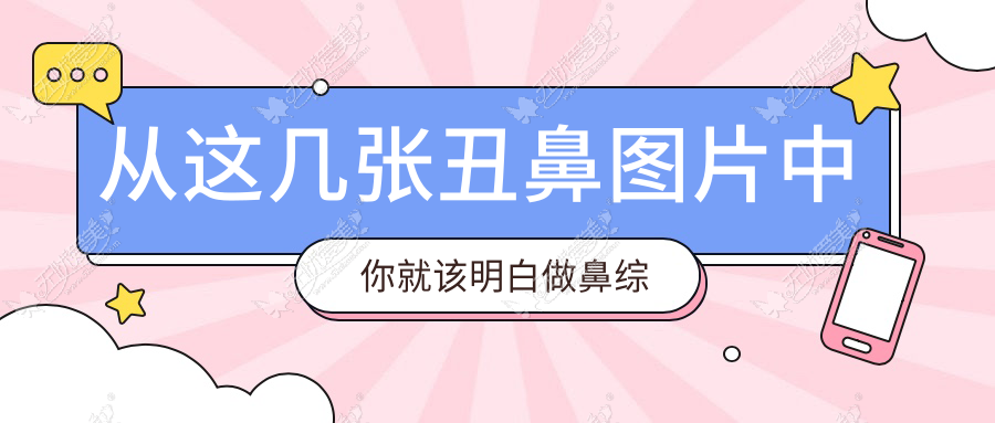 从这几张丑鼻图片中你就该明白做鼻综合是多么重要！