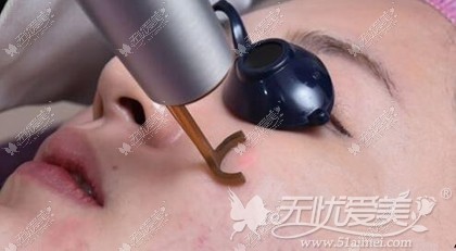 温州星范皮秒激光美肤