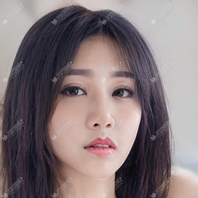 吸脂隆胸有哪些常见优点