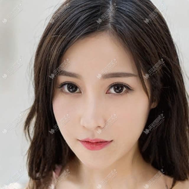 那些选择做手臂吸脂告别“拜拜肉”的人都恢复怎么样了？