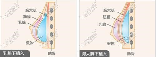 成都纽莱茵胸部特色项目