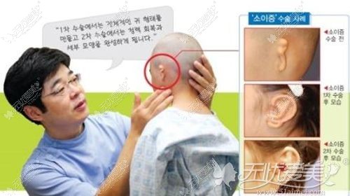 韩国普罗菲耳郑在皓院长